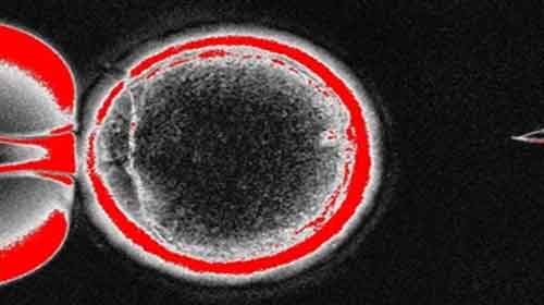Foto de Clonagem: o que é, humana,terapêutica, reprodutiva, tipos, importância
