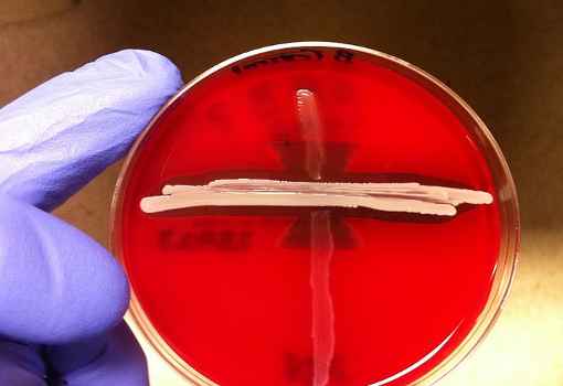 Foto de Se a doença é bacteriana, posso tomar antibióticos por conta própria?
