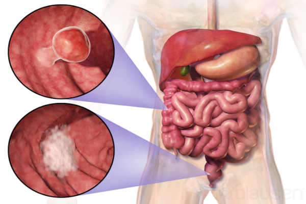 Intestino Grosso: função, anatomia, histologia