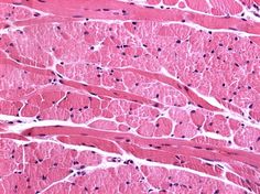 Tecido muscular: liso, estriado esquelético e cardíaco